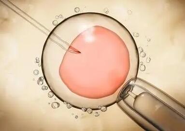 试管婴儿胚胎移植后注意事项及移植成功的6个症状可自行对照观察